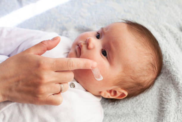 嬰兒與特應性皮炎得到奶油放。濕疹的護理和預防。 - 濕疹 個照片及圖片檔