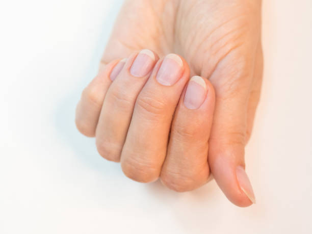 istock Completed manicure, prepared nails for applying varnish 1222210480