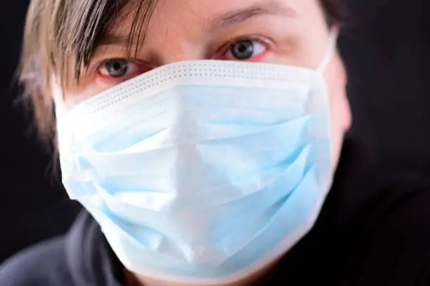 Photo of Woman in a medical mask with red eyes.