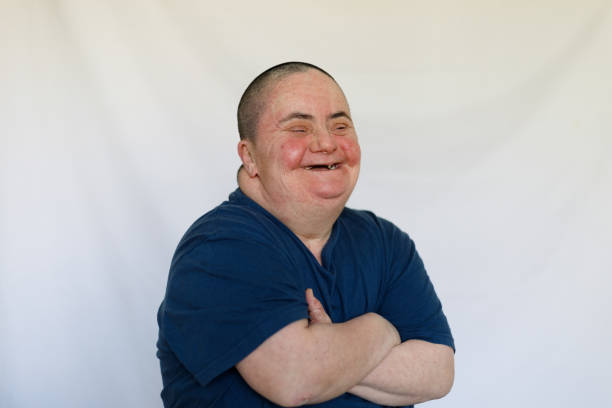 istock Woman with down syndrome smiling 1222292490