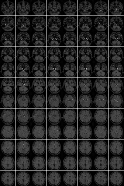 obrazy mri głowy - human nervous system cat scan brain doctor zdjęcia i obrazy z banku zdjęć