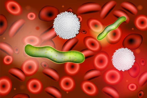 Sepsis is an inflammatory immune response triggered by an infection. Sepsis (Blood Infection). Etiologic Agents of Bacterial Sepsis. Sepsis is an inflammatory immune response triggered by an infection. blood and guts stock illustrations