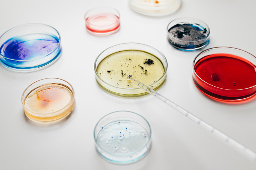 Petri dishes with different bacterial cultures grown in them.