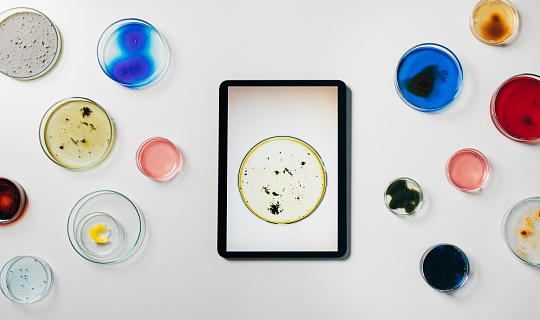 Photo of bacterial cultures in a petri dish displayed on a digital tablet laid on a table full of colourful petri dishes.