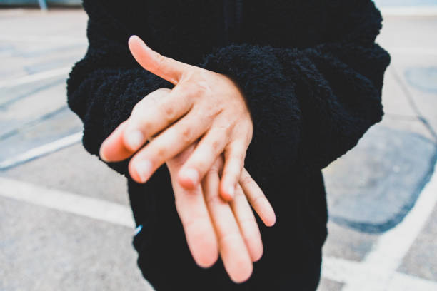 Discolouration of nails after chemotherapy. Hands of cancer patient, skin and nails loss of cancer patient, chemotherapy side effects, cancer treatment process