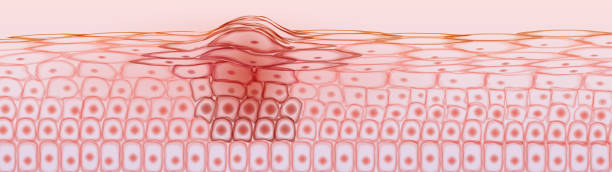 Skin tissue cancerous cells, melanoma Skin tissue cancerous cells, melanoma human cell nucleus stock illustrations