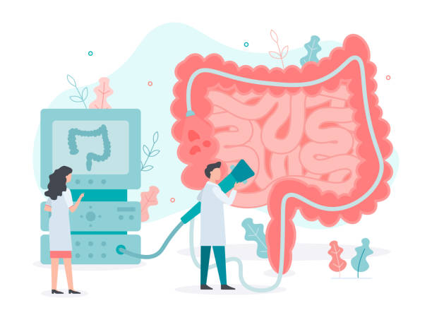 Colonoscopy bowel health concept A team of doctors performs colonoscopy, diagnostics of the intestine. Bowel health. Medical concept with tiny people. Flat vector illustration. colonoscopy stock illustrations