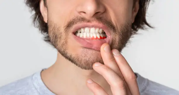 Photo of Man suffering from toothache, tooth decay or sensitivity