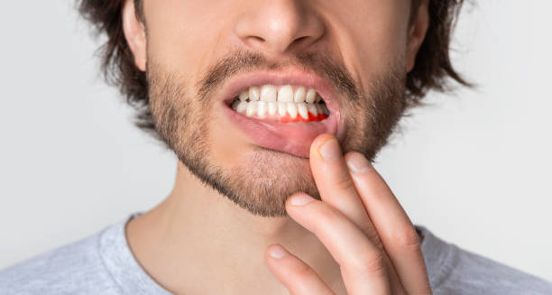man suffering from toothache, tooth decay or sensitivity - healthy gums fotos imagens e fotografias de stock
