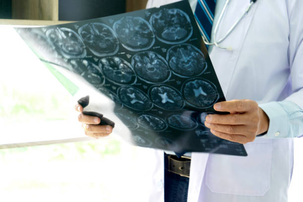 istock Doctor hold brain X-ray scan film 1223003399