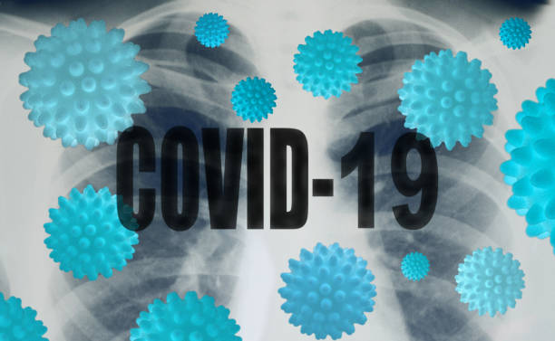 istock Inscription COVID-19 on Chest Radiograph Background 1223077113
