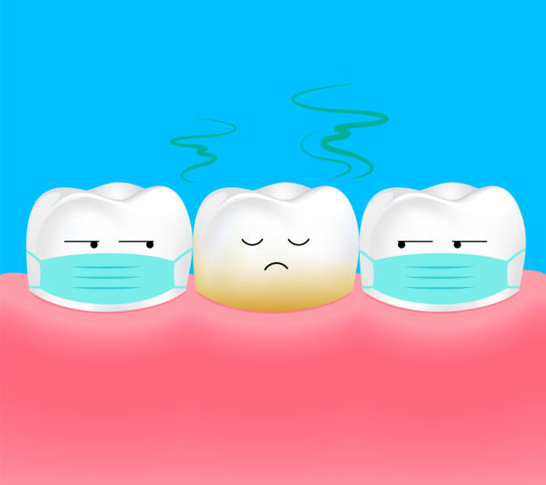 ilustraciones, imágenes clip art, dibujos animados e iconos de stock de diente insalubre. el diente es halitosis o mal aliento. - dental issues