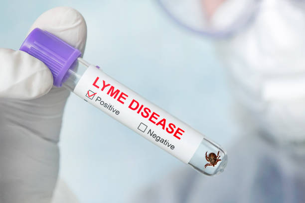 Lyme disease label on a test tube in the hands of a laboratory assistant. dangerous carrier of Lyme disease in glass vial in a doctor's office. Diagnosing patients after a tick bite. dangerous carrier of Lyme disease in glass vial in a doctor's office. Lyme disease label on a test tube in the hands of a laboratory assistant. Diagnosing patients after a tick bite. lyme disease photos stock pictures, royalty-free photos & images