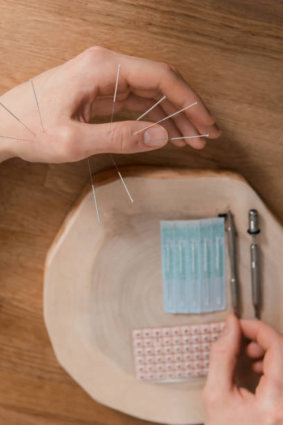 istock Man using acupuncture treatment for pain relief 1223261801