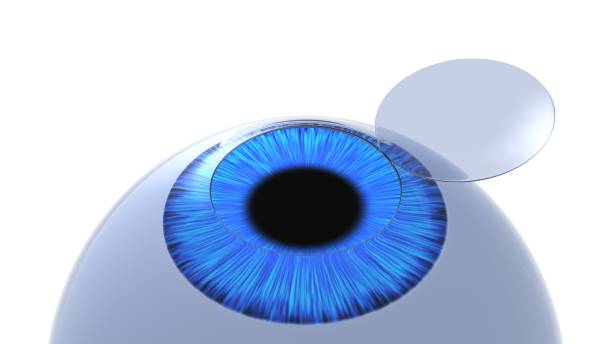 Corneal flap eye illustration. Isolated on white. 3D-rendering. Corneal flap eye illustration. Isolated on white. 3D-rendering. cornea stock pictures, royalty-free photos & images