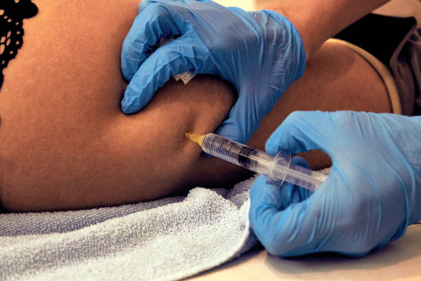 istock Woman lying on bed and getting Botox injection. 1223376598
