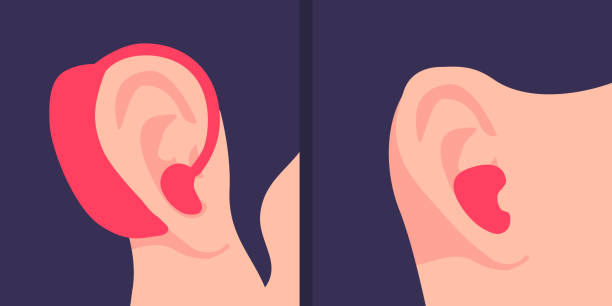 人間の耳の補聴器のクローズアップ画像。運河とbte - 耳の後ろの補聴器。 - hearing aid点のイラスト素材／クリップアート素材／マンガ素材／アイコン素材