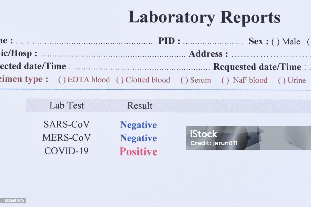 Positive Test Result Of Covid19 Virus Stock Photo Download Image Now Positive Test Result Of Covid19 Virus Stock Photo Download Image Now