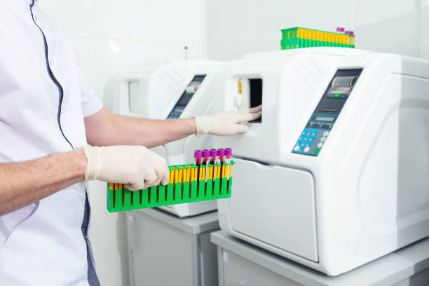 manos de un asistente de laboratorio en guantes de cerca realizando investigaciones con la ayuda de un analizador - laboratory blood laboratory equipment medical sample fotografías e imágenes de stock