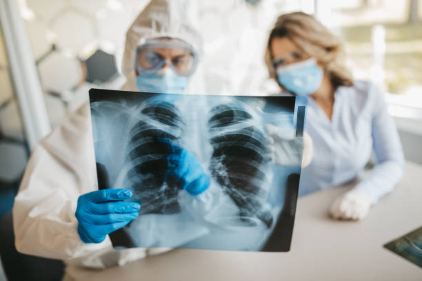 doctors looking at lungs x-ray - protective suit fotos imagens e fotografias de stock