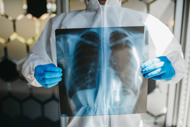 istock Doctor in protective suit looking at lungs x-ray 1223774975