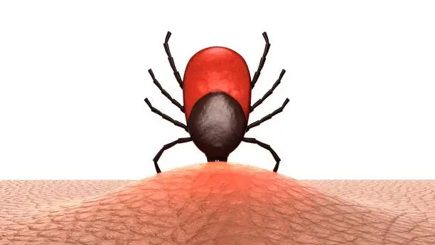 Female tick embedded in human skin. 3D-rendering.