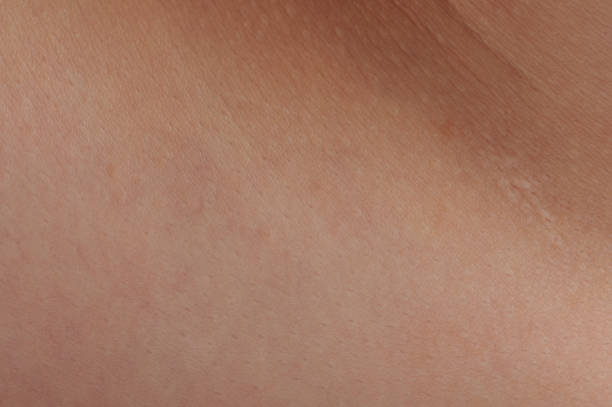 istock Brown healthy human skin 1224024677