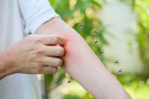 démangeaisons de l’homme et grattage sur le bras de la cause d’éruption cutanée d’allergie par la morsure de moustiques - moustique photos et images de collection