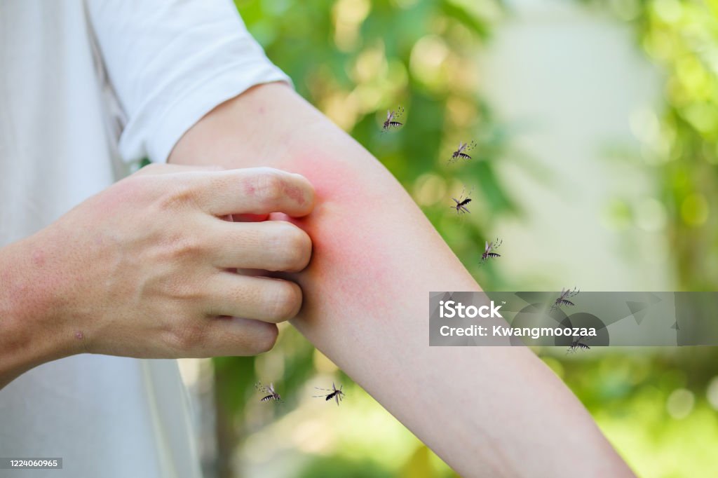 Man itching and scratching on arm from allergy skin rash cause by Mosquitoes bite Mosquito Stock Photo