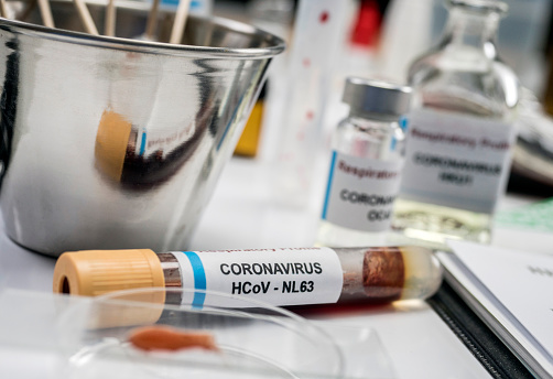Vial with sample of covid-19 coronavirus infected person in a laboratory, conceptual image