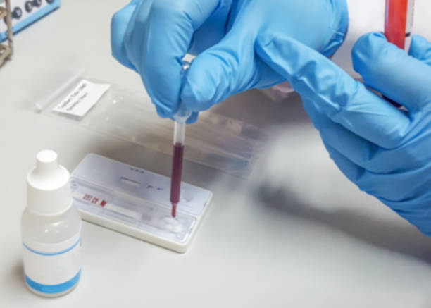 istock COVID-19 or coronavirus rapid test concept. Blur background scientist or lab technologist working in university research laboratory testing blood sample in science room examination hospital. 1224263239
