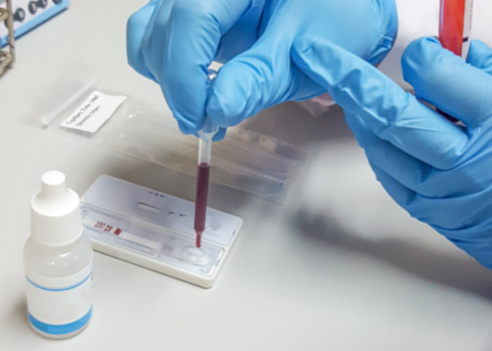 COVID-19 or coronavirus rapid test concept. Blur background scientist or lab technologist working in university research laboratory testing blood sample in science room examination hospital.