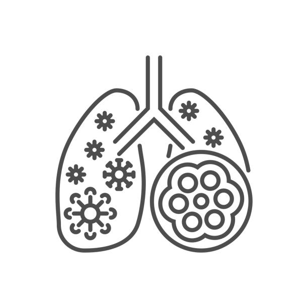 Pneumonia related vector thin line icon. Pneumonia related vector thin line icon. Lungs with alveoli and coronavirus. Isolated on white background. Editable stroke. Vector illustration. clip art of a diagram of human lungs stock illustrations