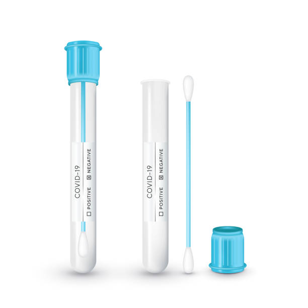 Test tube with cotton swab for nasopharyngeal specimens. Realistic tube for testing in laboratory on coronavirus SARS CoV-2. Nasopharyngeal test for determination Covid-19 NCP. Vector illustration. Test tube with cotton swab for nasopharyngeal specimens. Realistic tube for testing in laboratory on coronavirus SARS CoV-2. Nasopharyngeal test for determination Covid-19 NCP. Vector illustration bloody nose stock illustrations