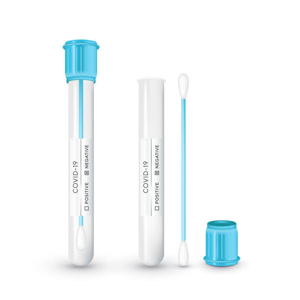 Test tube with cotton swab for nasopharyngeal specimens. Realistic tube for testing in laboratory on coronavirus SARS CoV-2. Nasopharyngeal test for determination Covid-19 NCP. Vector illustration. Test tube with cotton swab for nasopharyngeal specimens. Realistic tube for testing in laboratory on coronavirus SARS CoV-2. Nasopharyngeal test for determination Covid-19 NCP. Vector illustration cotton swab stock illustrations