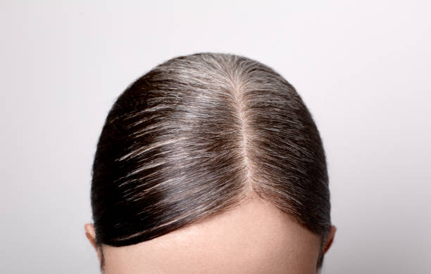 istock Gray hair root ready for dyeing, close up 1224346370