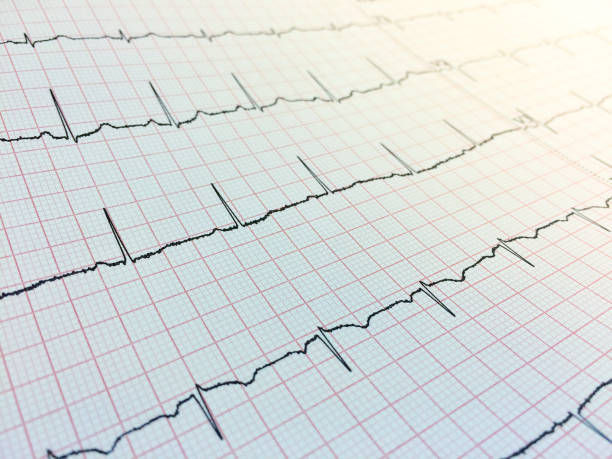 istock Close up of Electrocardiogram, Electrocardiography or EKG chart. 1224518736