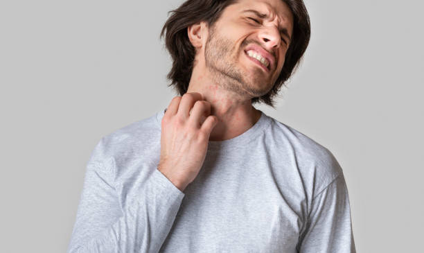 istock Allergy rash. Man suffering from itching on skin and scratching throat 1224541433