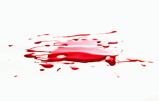 Blood spatter on white.