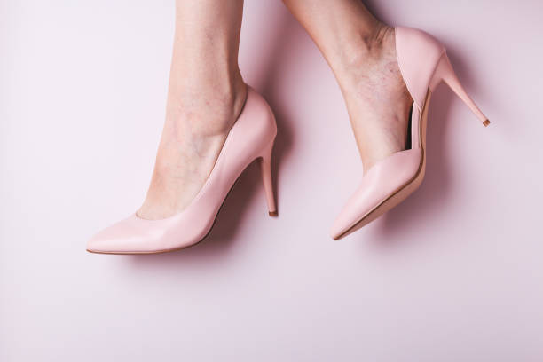 Woman feet in pink shoes closeup with small spider veins, leg disease. Unhealthy side effect of wearing high heels that provokes varicose veins, copy space, top view Woman feet in pink shoes closeup with small spider veins, leg disease. Unhealthy side effect of wearing high heels that provokes varicose veins women high heels stock pictures, royalty-free photos & images