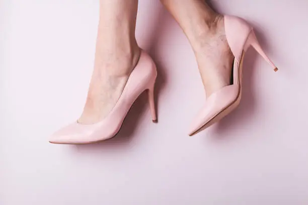 Woman feet in pink shoes closeup with small spider veins, leg disease. Unhealthy side effect of wearing high heels that provokes varicose veins