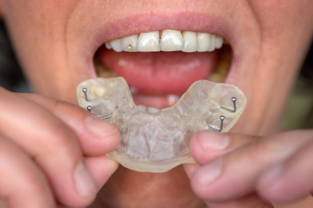 istock Woman suffering from bruxism holding up a guard 1224786558