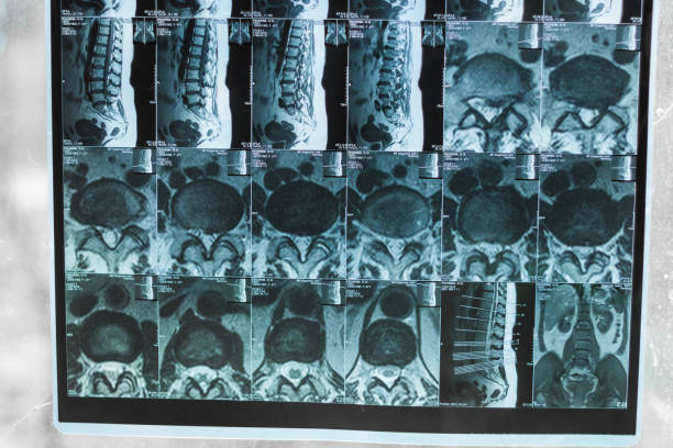 istock X-ray of the legs and hips 1224796610