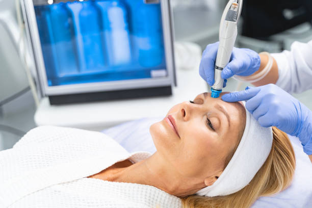 Female patient undergoing a facial hydrodermabrasion treatment Relaxed mature blonde lady in a headband lying on a couch in a beauty clinic hair care women mature adult human skin stock pictures, royalty-free photos & images