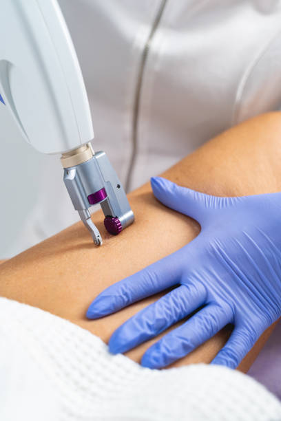 istock Dermatologist performing a non-invasive skin tightening procedure 1224799151