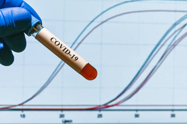 pcr 진단 covid-19. - nitril 뉴스 사진 이미지