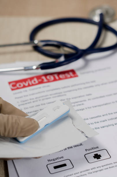 Laboratory scientist performs a rapid diagnostic test (rdt) for antibodies to detect the presence of viral proteins. caused by coronavirus disease COVID-19, PCR laboratory test. Inputs for testing científico de laboratorio realiza una prueba de diagnóstico rápido (rdt) para anticuerpos para detectar la presencia de proteínas virales. causada por la enfermedad coronavirus covid-19, prueba de laboratorio de pcr. entradas para pruebas