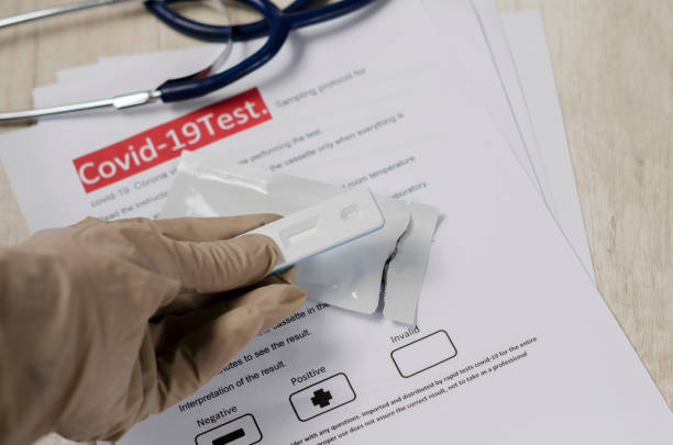 Laboratory scientist performs a rapid diagnostic test (rdt) for antibodies to detect the presence of viral proteins. caused by coronavirus disease COVID-19, PCR laboratory test. Inputs for testing científico de laboratorio realiza una prueba de diagnóstico rápido (rdt) para anticuerpos para detectar la presencia de proteínas virales. causada por la enfermedad coronavirus covid-19, prueba de laboratorio de pcr. entradas para pruebas