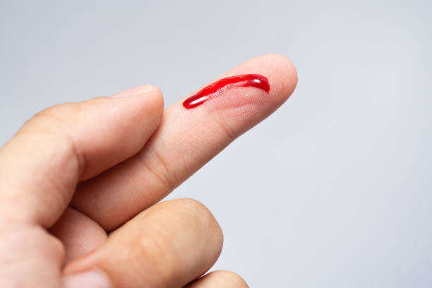Bleeding blood from the cut finger wound. stock photo