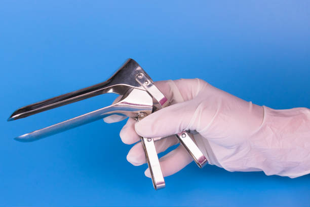 espejo ginecológico en la mano de un médico sobre un fondo azul. herramienta médica. - espéculo fotografías e imágenes de stock
